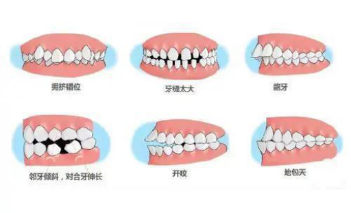 对牙医的评价的*典语录（赞美牙科医生的*典语录）(图1)